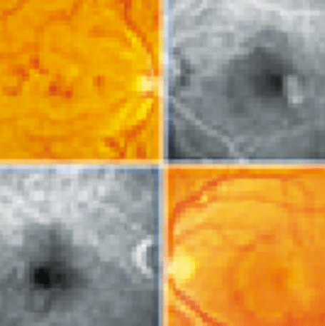 Logo RETINA